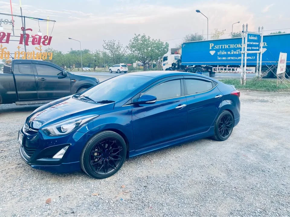 2015 Hyundai Elantra V 2
