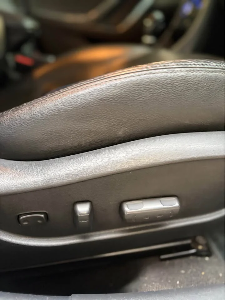 2015 Hyundai Elantra V 2