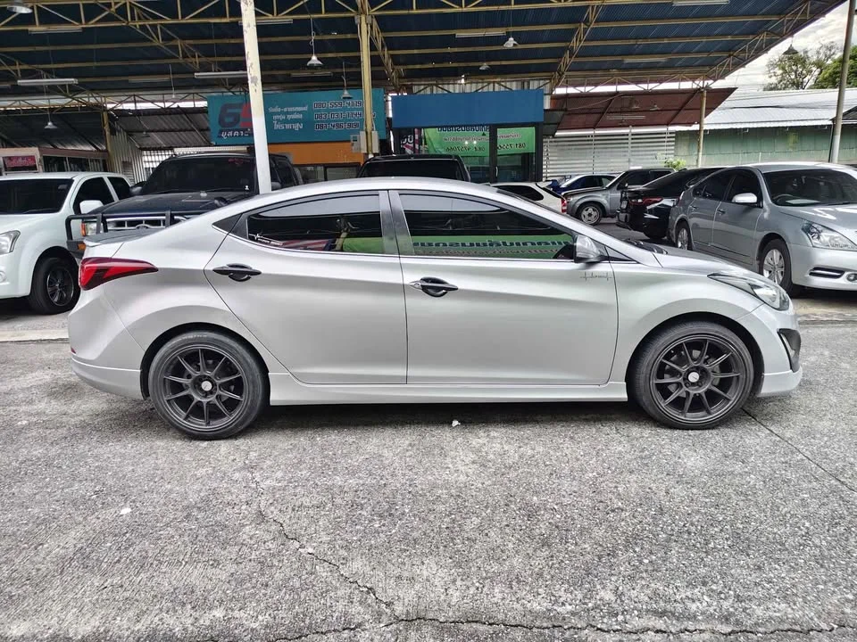 2017 Hyundai Elantra V 3