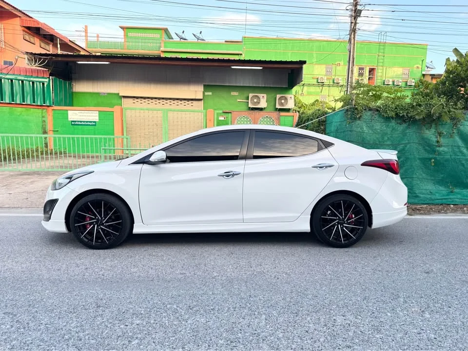 2016 Hyundai Elantra V 3